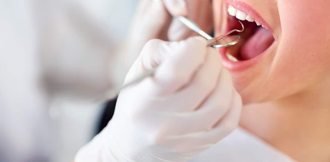 Les soins des gencives : technique parodontologie | Dr Temstet | Paris 17