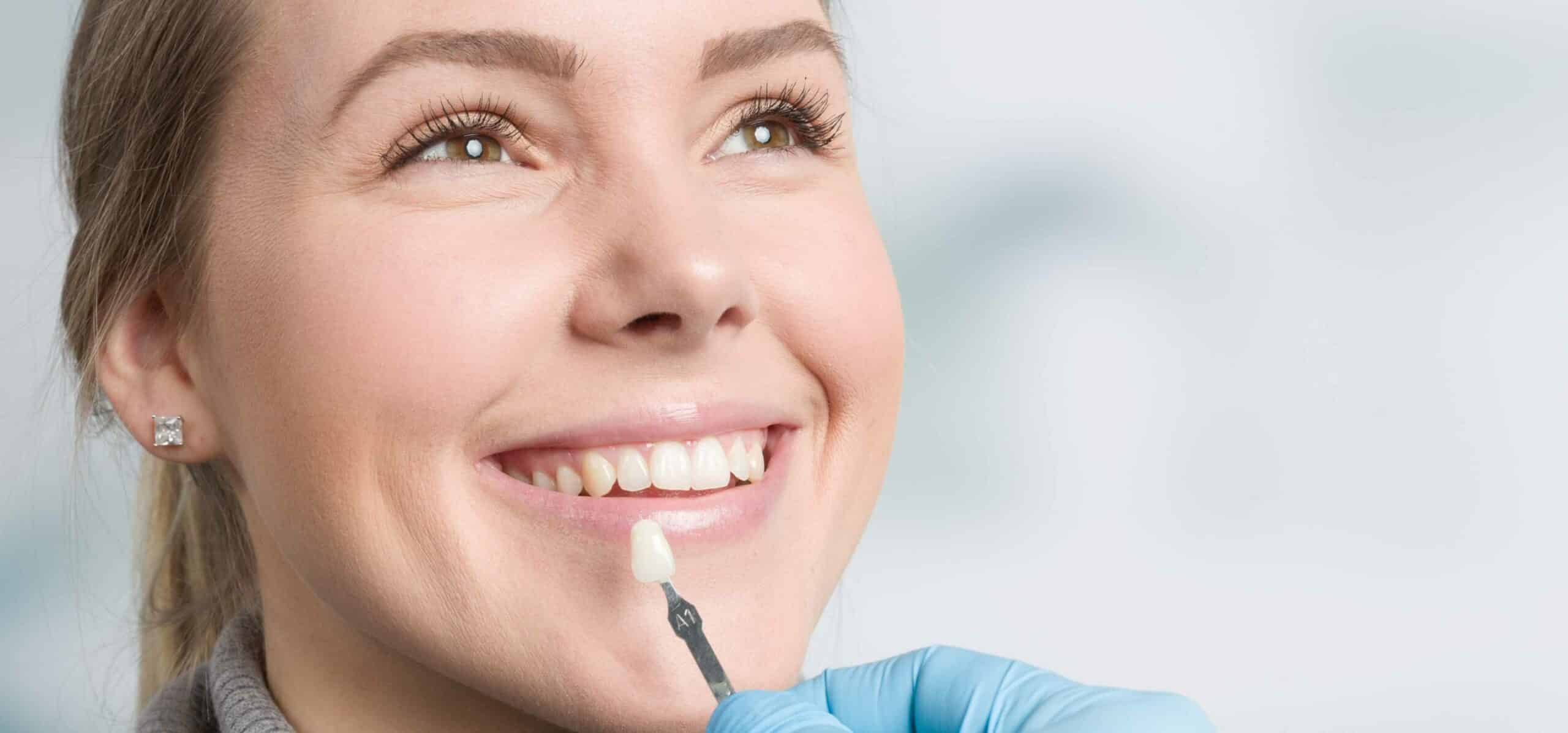 Facettes dentaires : quelle durée de vie ?| Dr Temstet| Paris