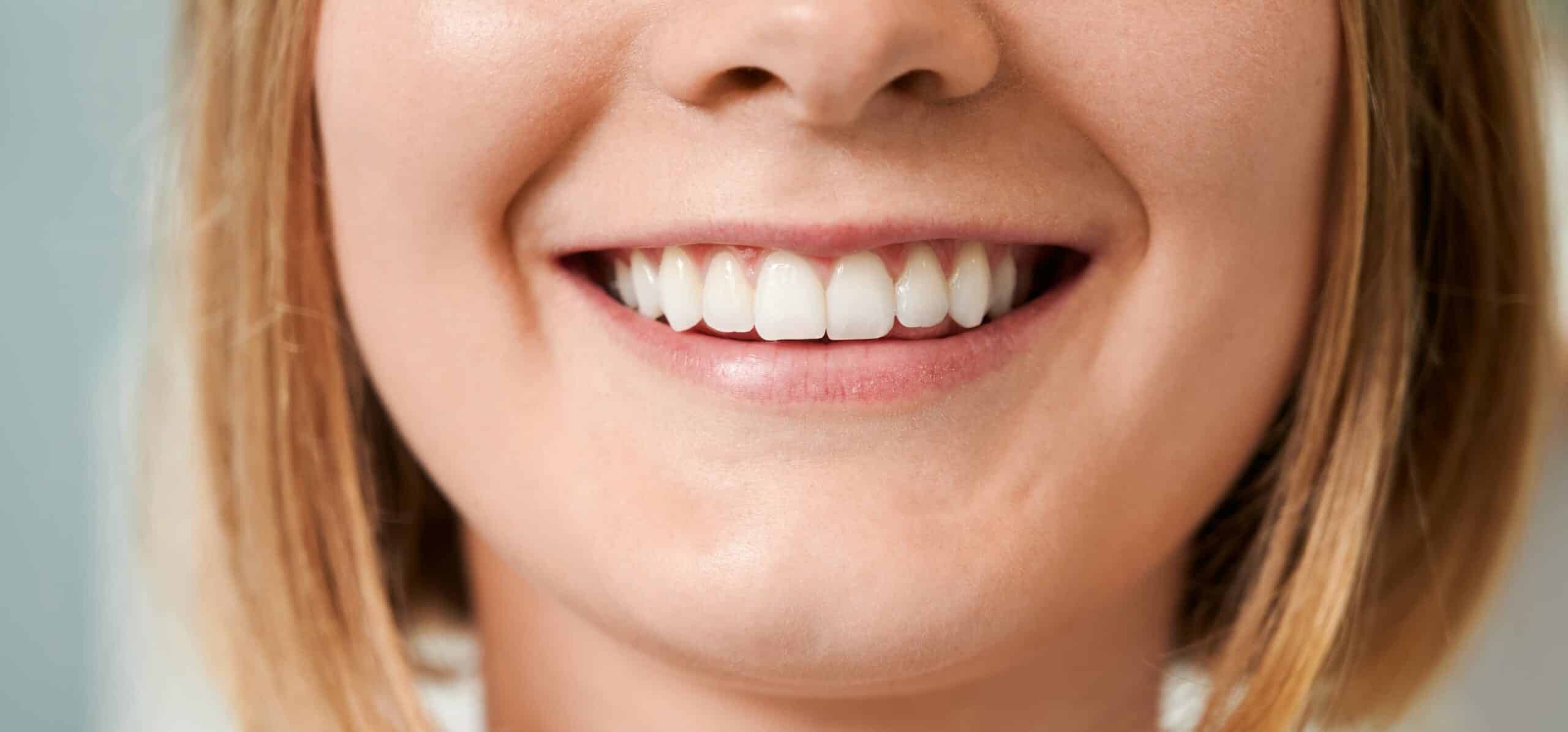 J’ai les dents jaunes : que faire ?| Dr Temstet| Paris