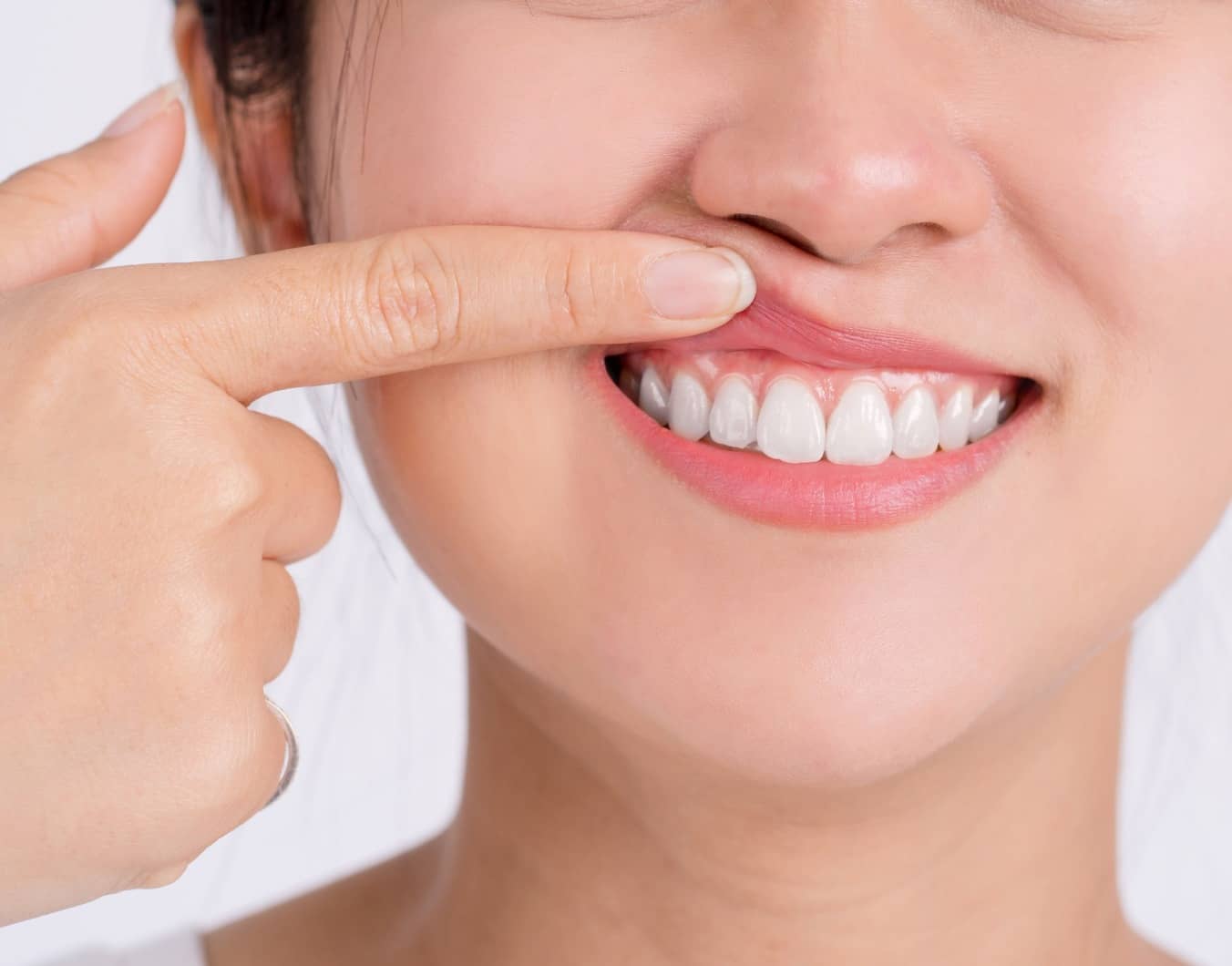 Comment savoir si j’ai une parodontite ? | Dr Temstet | Paris