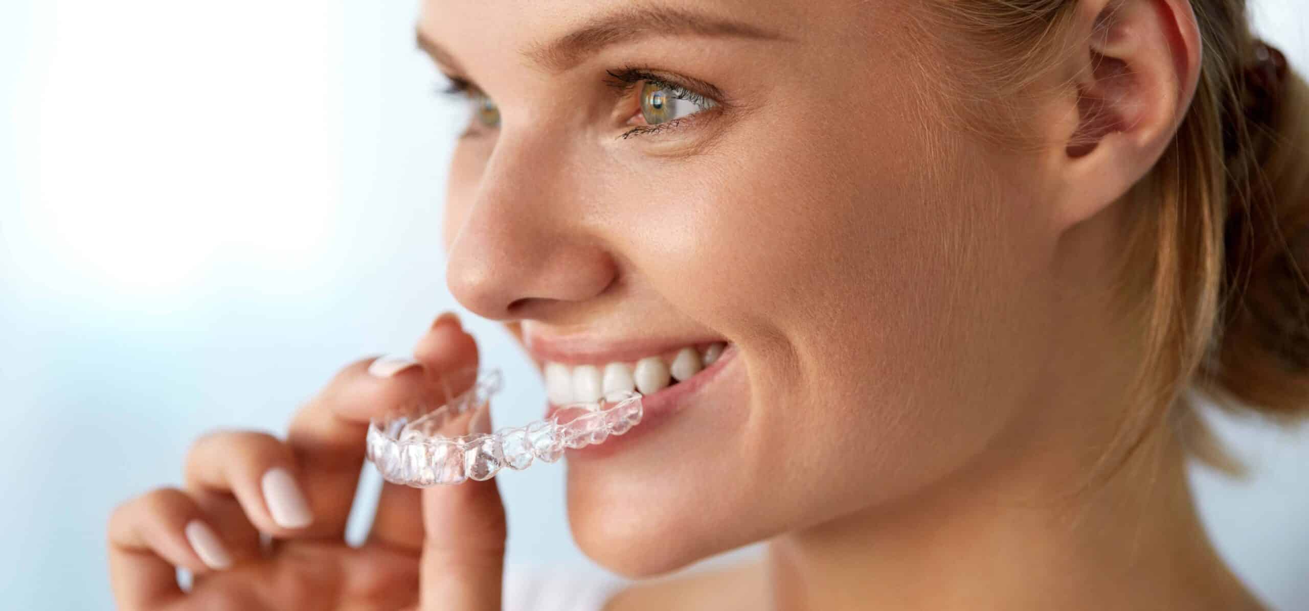 Peut-on suivre un traitement orthodontique avec des dents manquantes ? | Dr Temstet | Paris